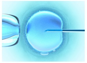 Assistance médicale à la procréation : trois techniques possibles