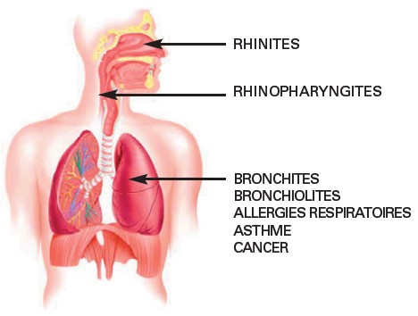 asthme et allergie