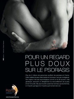 campagne psoriasis