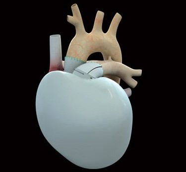 L’essai clinique du Coeur artificiel de CARMAT va pouvoir reprendre