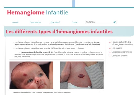 Hémangiome infantile : un site pour aider les parents à comprendre et s'orienter