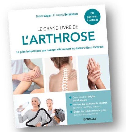 Arthrose : un guide pratique et illustré