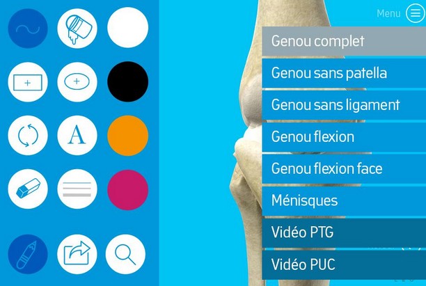 Une appli avec vidéos en 3D pour expliquer aux patients leur opération chirurgicale du genou ou de la hanche